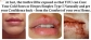How To Cure Your Cold Sore Naturally And Forever