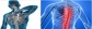 Chiropractor, Sports Injuries, Disc Herniation, Carpal Tunnel, Disc Herniation and Auto Accident Inj