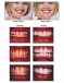 Teeth Whitening - Dentist - Chicago