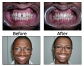 The Best Local Dentist in Chicago - Dr. Theodore M. Siegel