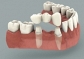 best dental braces clinic in ahemadabad,gurgaon,noida,delhi,chandigarh,