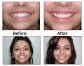 Chicago Cosmetic Dentist