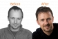 FUE Hair Transplant in India