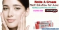 Prescription free acne treatment with buy tretinoin cream
