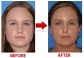 Free Beauty Tips And Tricks For Glowing Face Lifts