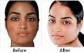 Best natural herbal cream & oil for skin lightening +27732594216