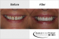 Dentist - Cosmetic Dentistry Chicago IL