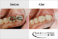http://www.zikbay.com/United+States/view-ad/Teeth-Straightening-661002.aspx