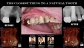 Multiple Tooth Implants in Fremont CA