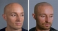 Scalp Micro-pigmentation training and Business Opportunity