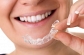 Affordable Dentist Los Angeles