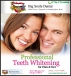 Teeth Whitening in Chicago