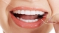 Affordable Invisalign in Burlington ON