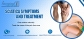 Bring End To The pain Of Sciatica With Home Treatments 