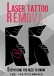 Laser Tattoo Removal in India +91-9711586419
