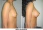 BREAST, HIPS & BUMS ENLARGEMENT CREAM BREAST, HIPS AND BUMS ENLARGEMENT CREAM / GEL +27787785919
